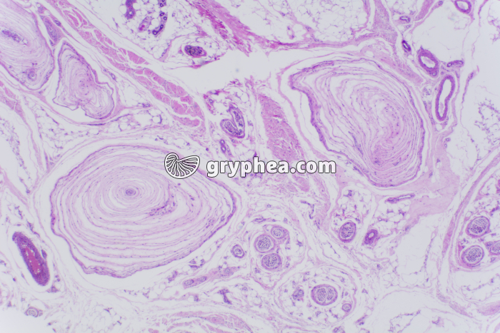 Peau du doigt avec corpuscules de Pacini x10 - gryphea.com